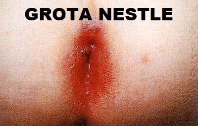 GROTA NESTLE