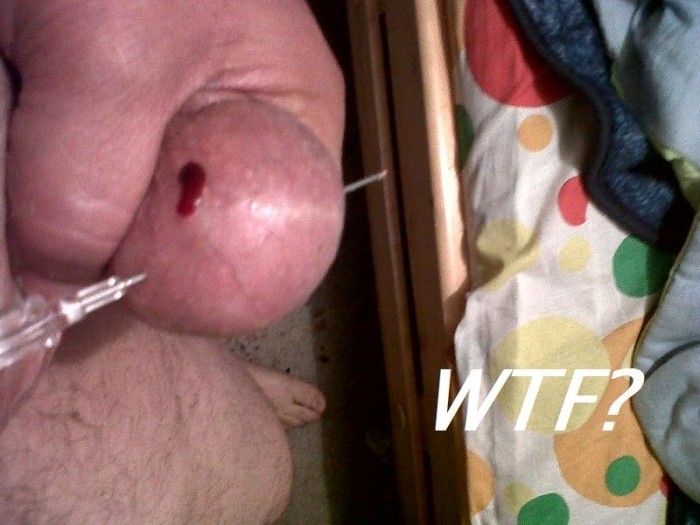 WTF??