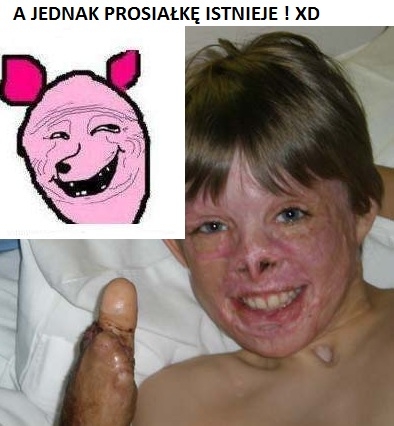 Prosia?k? XD