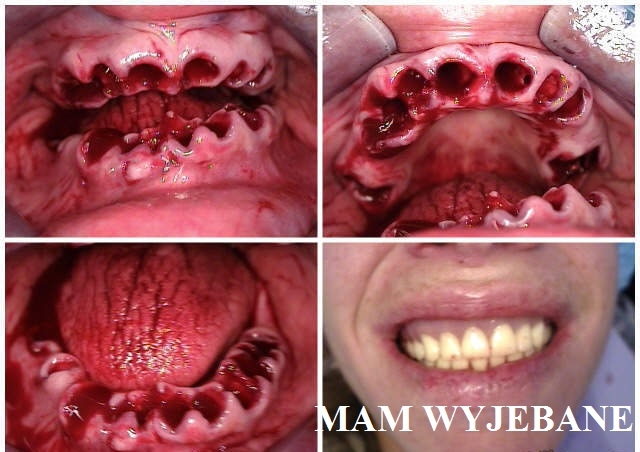 WYJEBANE