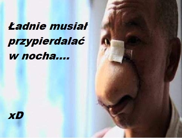 Ale se walił w nocha