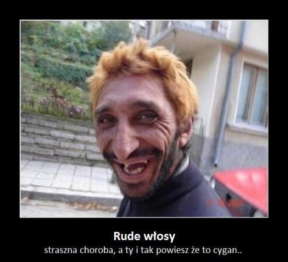 Ruda choroba