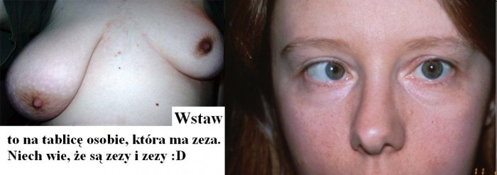 zez :D
