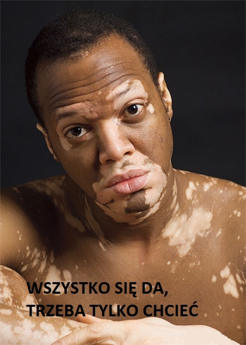 Znaleziono lekarstwo na straszną chorobę