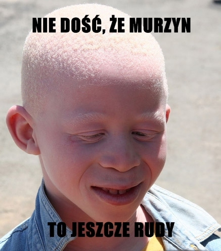 biały murzyn