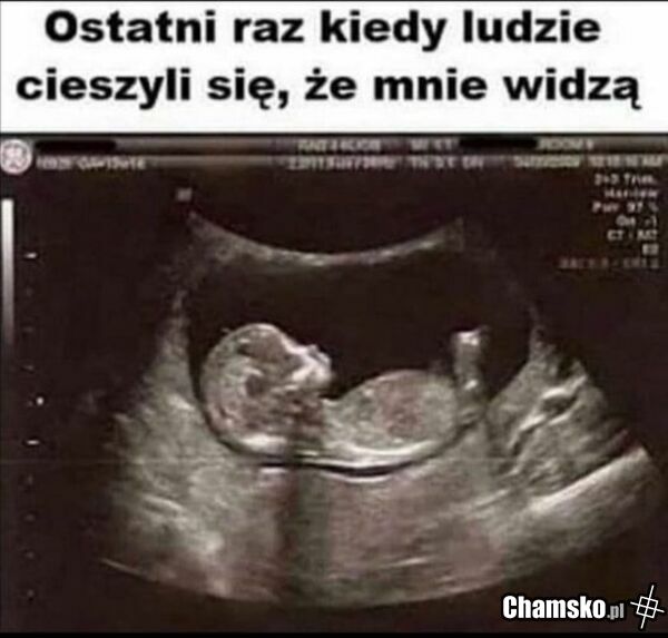 RASISTA POZDRAWIA!!!!!!