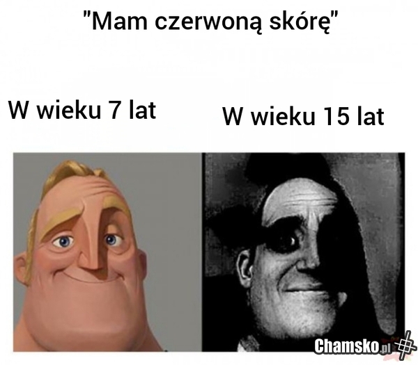 Skóra