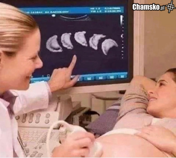 ale będzie sranie