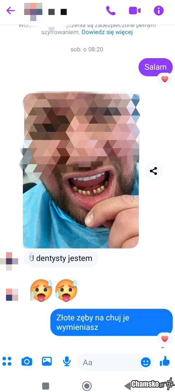 zlote zeby