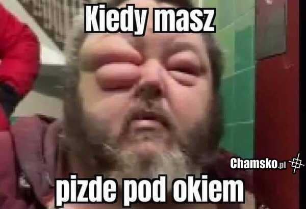 Oko