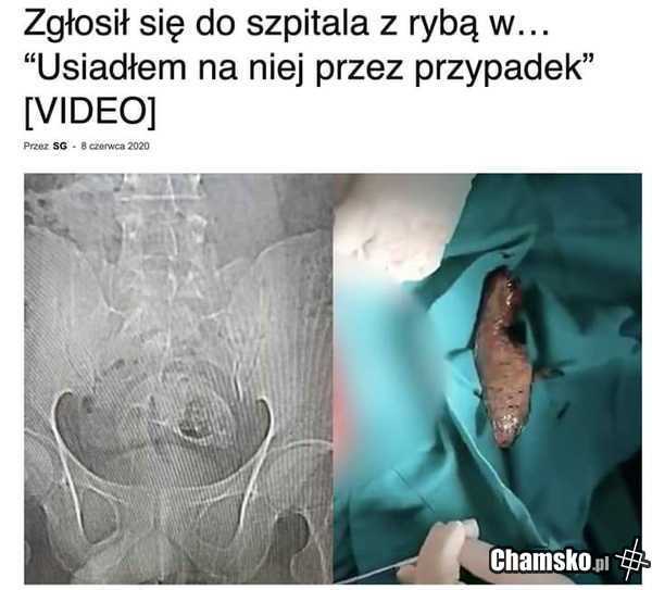 Dziwny przypadek