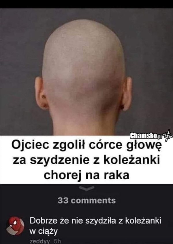 Ogolenie głowy