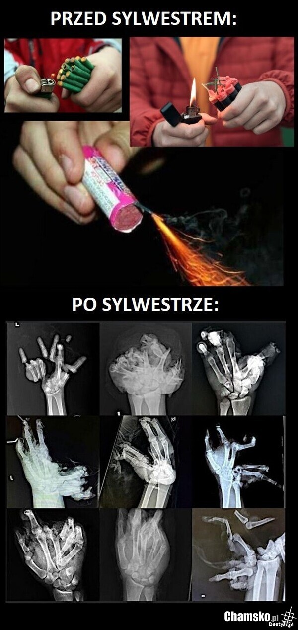 Petardki