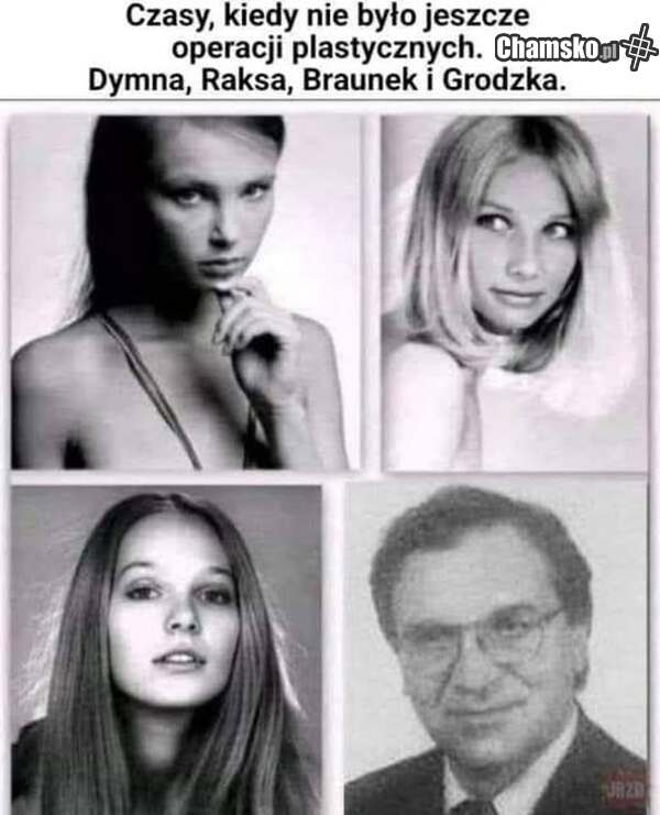Czasy sprzed operacji plastycznych