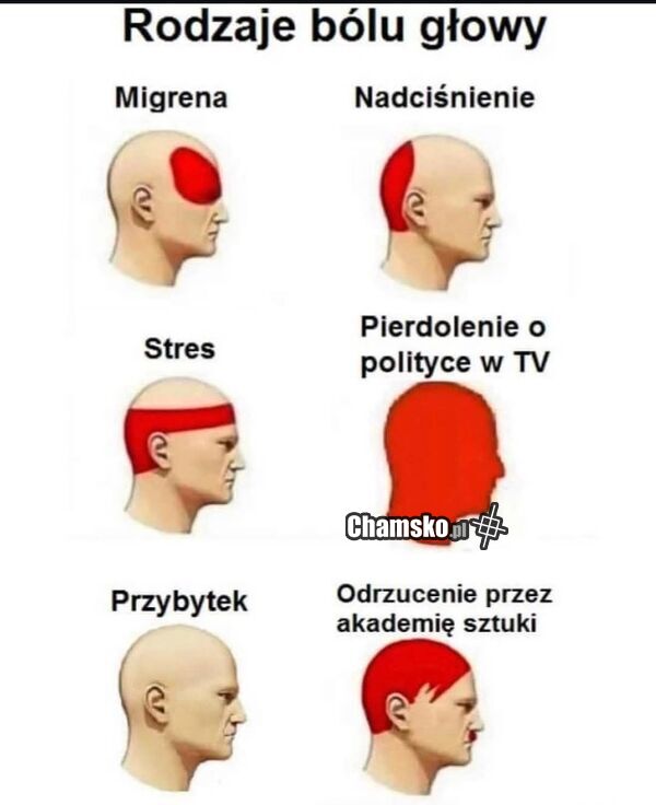 Bóle głowy