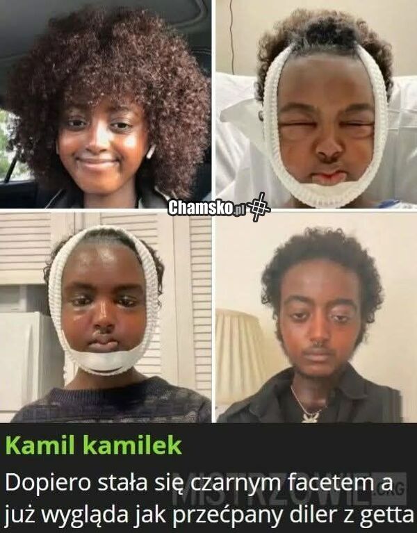 Zmiana płci