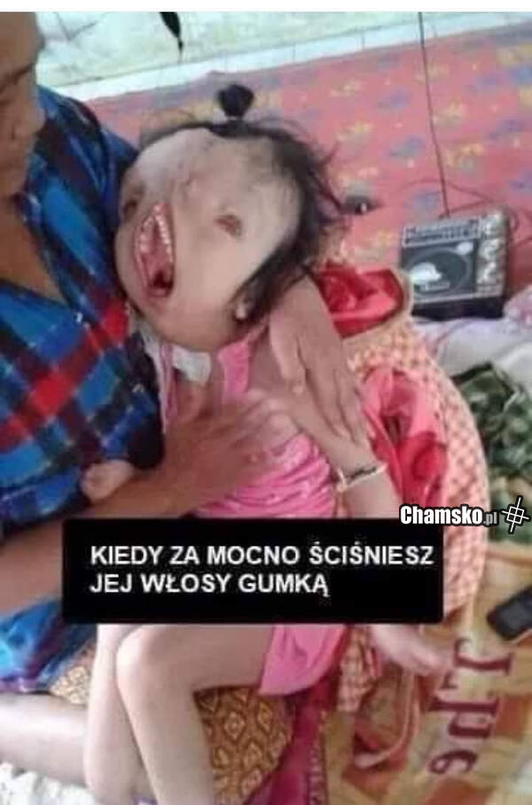 Spinanie włosów