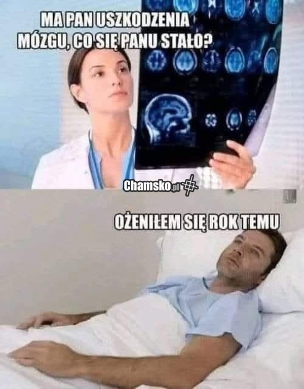 Uszkodzenia mózgu