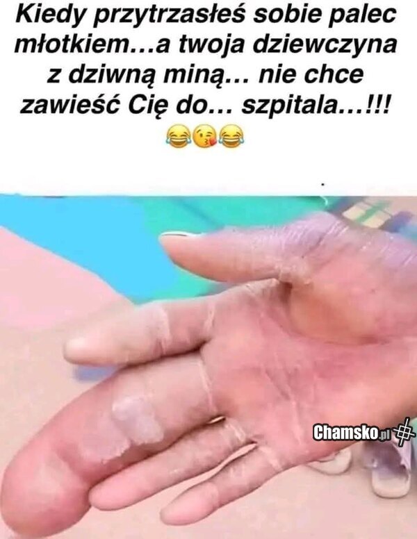 Wypadek z młotkiem