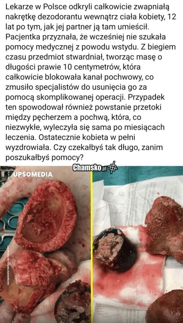 Dezodorant w dziurze