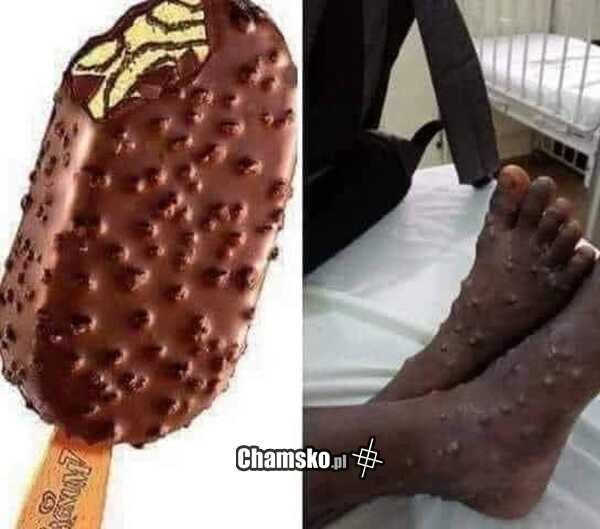 Lody