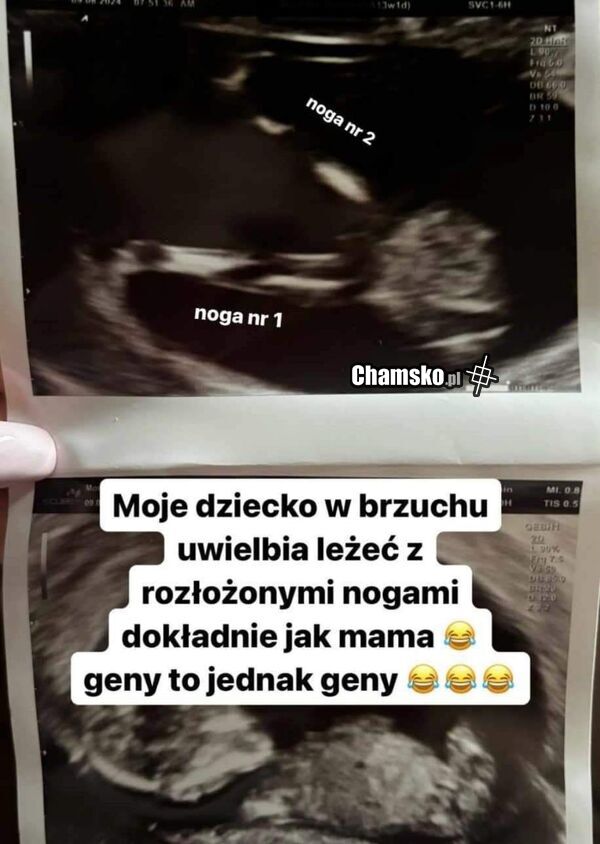 Pozycja