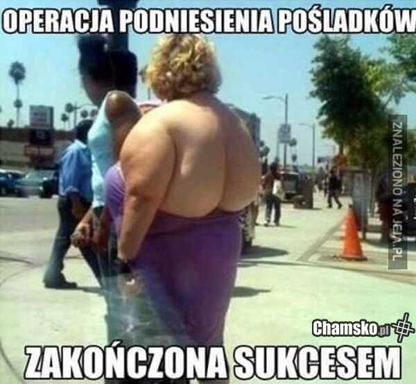 Operacja pośladków