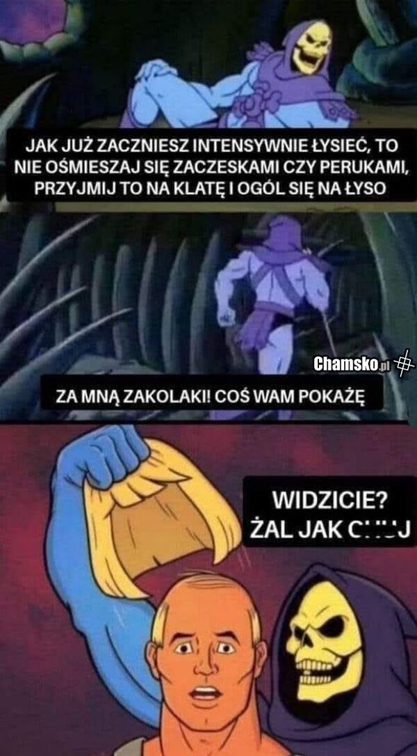 Łysienie