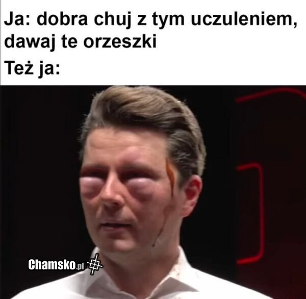 Uczulenie na orzeszki
