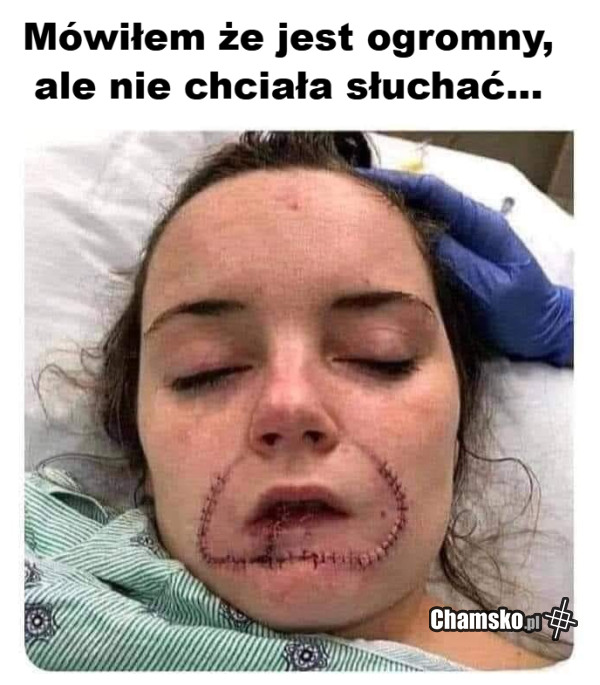Gdy laska nie słucha