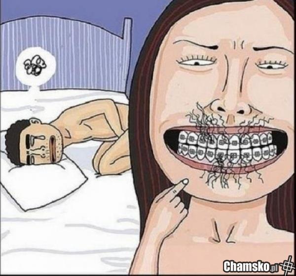 Ups !!!