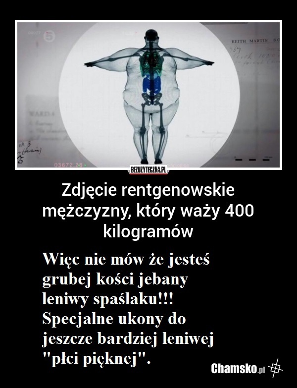 Taka Prawda Leniwe Grubasy