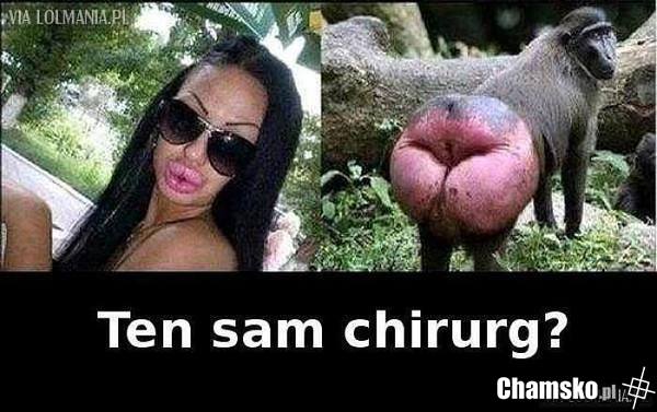 ten sam chirurg?