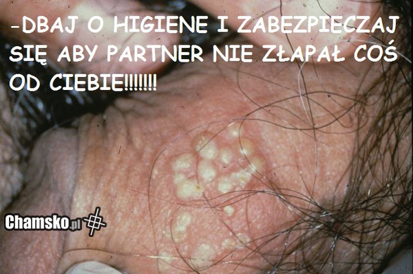 ZABEZPIECZAJ SIĘ..........