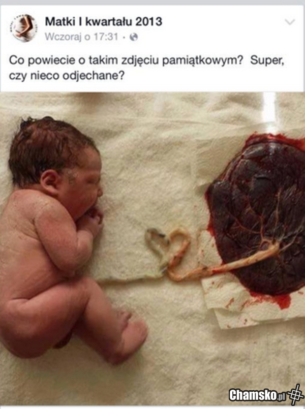 Artyzm jak cholera