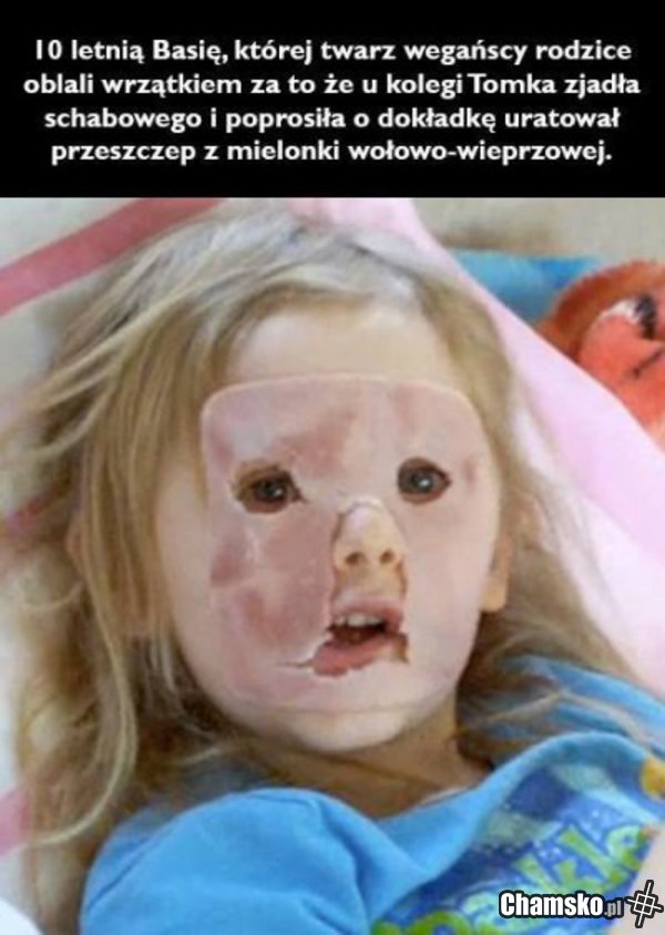 Przeszczep