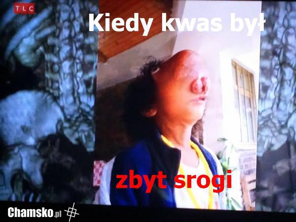 Zbyt Srogo