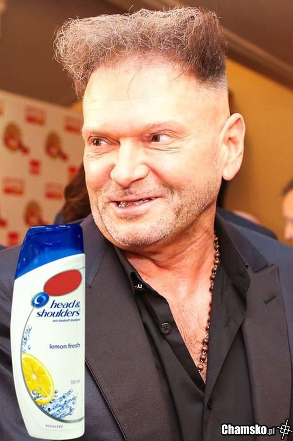 Piękne włosy bez łupieżu