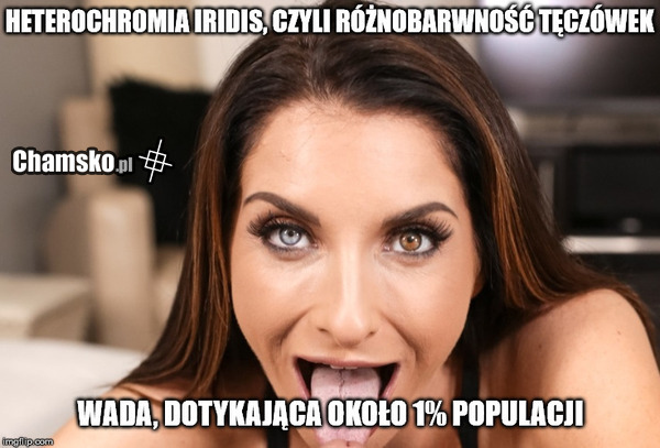 Piękna wada