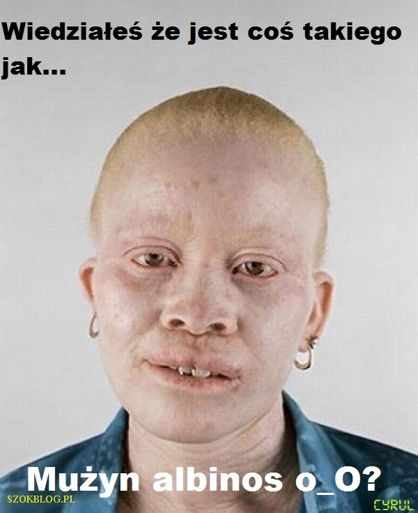 MU?YN ALBINOS