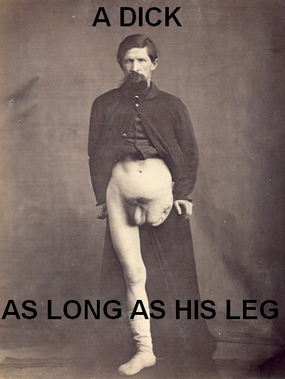 Dick