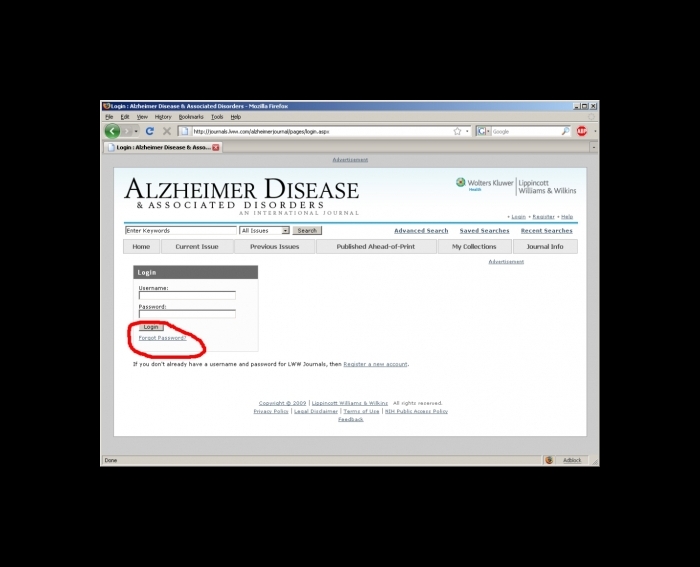 Alzheimer